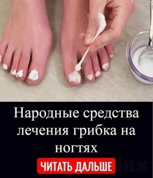 Лечение грибка нашатырный спирт