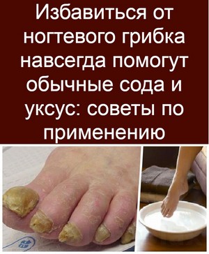 Лечение грибка на ногтях лаком