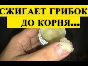 Грибы лечение грибка ногтей