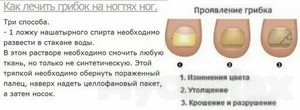 Народные средства лечения грибок ногтях