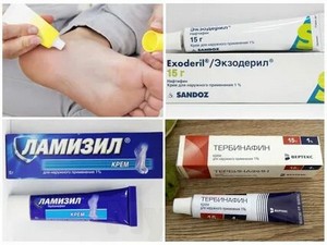 Профилактика и лечение грибка кожи и ногтей