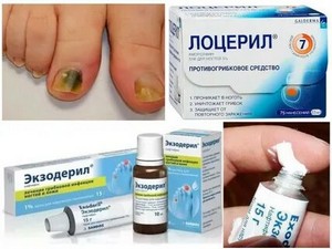 Капсулы для лечения грибка ногтей