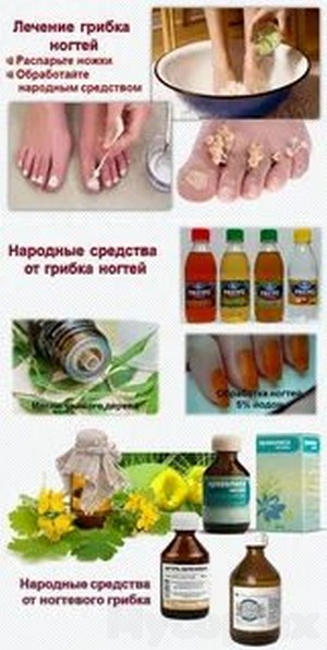 Утолщение ногтей на ногах грибок лечение