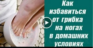 Лечение лазером грибок ногтей отзывы цена