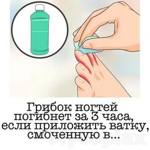 Лечение уксусом грибок ногтей