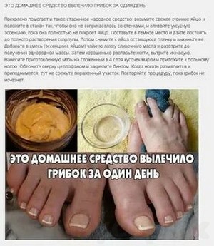 Отзывы лечение грибка