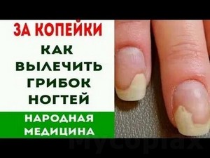 Пластыри для лечения грибка ногтей