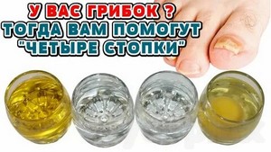 Самостоятельное лечение грибка ног