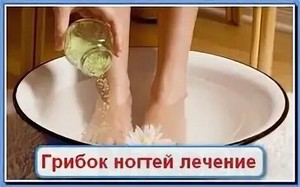 Гель для лечение грибка ногтей