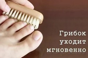 Грибок ногтей на ногах лечение в домашних условиях форум отзывы