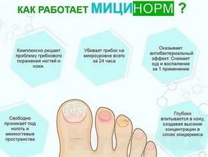 Живая и мертвая вода лечение грибка ногтей