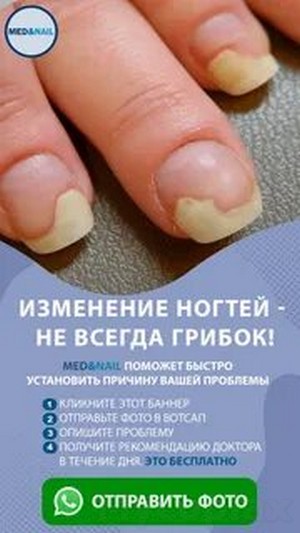 Грибок лапы лечение