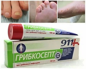 Грибок ногтей на ногах лечение уксусом и глицерином