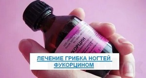 Технологии лечения грибка ногтей