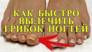 Асд 3 для лечения грибка ногтей