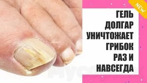 Клиника лечения грибка ногтей москва