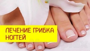 Народные средства лечения грибка на коже руками