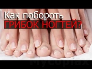 Лечение грибка ногтя уксусом в домашних условиях