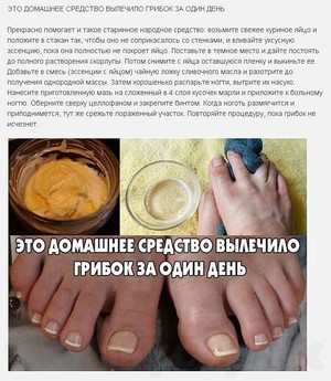 Лечение грибка лобкового