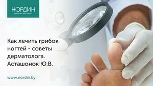 Лечение грибка ногтя лазером в кирове