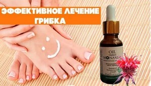 Лечение народными способами грибка ногтей на руках