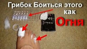 Яблочный уксус для лечения грибка кожи