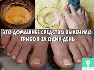 Мази для лечение грибка ног