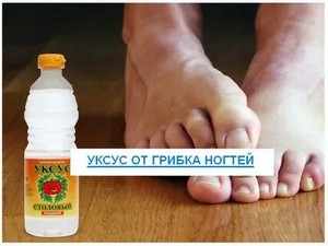 Клиника и лечение грибка на ногтях