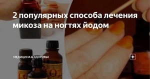 Лечение грибка ногтей в новосибирске лазером отзывы